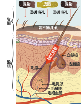 韩方分析的脱发原因